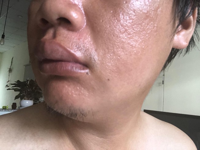 1 nhà báo bị đánh ở quận 9