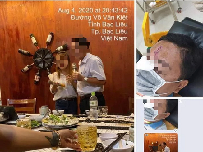Sự thật thông tin 'cán bộ Bạc Liêu bị đánh bể đầu vì bia ôm'