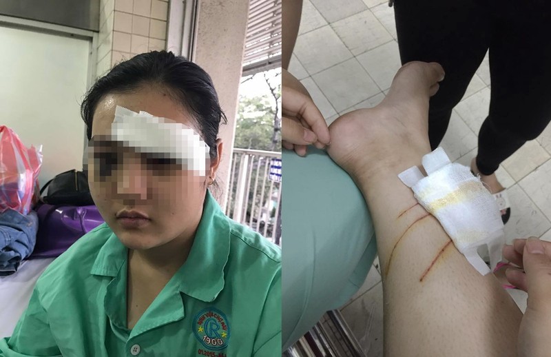 Phó thủ tướng yêu cầu điều tra vụ 'cắt tai thiếu nữ’ - ảnh 1