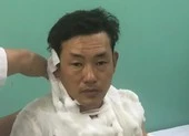 Bắt giam 5 cha con giết 2 người hàng xóm vì tranh chấp đất ảnh 2 Thanh niên cướp ngân hàng ở Bình Tân gây án như thế nào
