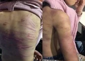Bé gái 12 tuổi bị bạo hành, mẹ nói 'chỉ muốn dạy dỗ ngoan hơn' ảnh 4 Bé gái 12 tuổi nghi bị bạo hành, xâm hại tình dục nhiều lần