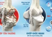 Tối 24-1 thêm 14.362 ca mắc COVID-19, TP.HCM chỉ có 97 ca ảnh 1 Coi chừng viêm khớp tự miễn hậu COVID-19