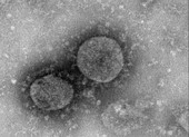 Sau khi cân nhắc, Mỹ không cấm bay đến Trung Quốc ảnh 3 Hong Kong nói về thời gian hoàn thiện vaccine ngừa corona