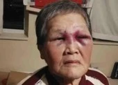 Mỹ điều đội cảnh sát ngầm gốc Á dẹp nạn phân biệt chủng tộc ảnh 5 Cụ bà gốc Á bị tấn công ở Mỹ quyên góp được 1 triệu USD