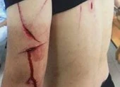 Lãnh 9 năm tù vì giúp mẹ giải quyết mâu thuẫn ảnh 3 Hàng chục côn đồ ở Hải Phòng chém trọng thương 1 người