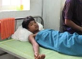 Rút dao đâm người sau khi va quẹt xe ảnh 3 Cứu sống nam sinh bị mũi tên sắt đâm thấu ngực
