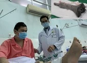 Ruồi, mèo 'quậy tưng' khu vực chế biến thực phẩm ảnh 2 Gắn mảnh ghép titan chịu lực gần 6 tấn cho bệnh nhân ung thư