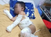 Nổ súng bắt nhóm thanh niên chuẩn bị 'bom xăng' đi đánh nhau ảnh 3 Bình Dương: 1 gia đình bị ném bom xăng, 2 bé trai bỏng nặng