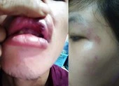 Người đập bàn khi hỏi tiền hỗ trợ COVID-19 bị phạt 200.000 đồng ảnh 1 Bị đánh vì đập bàn, chửi tổ trưởng 'ăn hết tiền' khi đi hỏi tiền hỗ trợ COVID