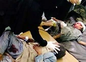 Vũ khí Mỹ và mạng người Yemen ảnh 5 LHQ: Đã quá đủ! Phải điều tra không kích Yemen 50 trẻ em chết