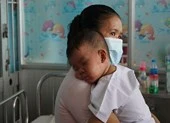 Dịch sởi bùng phát, lan rộng 43 tỉnh thành ảnh 1 Cần chế tài xử lý người không đưa trẻ đi tiêm chủng?