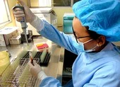 Chi tiết phân bổ 20 triệu liều Vero Cell và hơn 1 triệu liều Pfizer ảnh 1 Loạn giá xét nghiệm kháng thể SARS-CoV-2