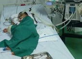 Lọc máu liên tục 56 giờ cứu thiếu nữ bị ong đốt vào chân ảnh 2 Chọc tổ ong vò vẽ, bé 4 tuổi bị đốt hơn 80 mũi phải đi cấp cứu
