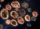 Virus SARS-CoV-2: Hiểu rõ về các biến thể nguy hiểm WHO đang theo dõi ảnh 3 Biến thể Mu đã xuất hiện ở 49/50 bang của Mỹ