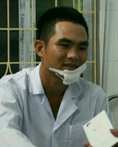 Dùng dao phóng lợn chém cảnh sát giao thông ảnh 1 Thiếu úy Hiếu đang được điều trị tại bệnh viện.