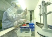 Hà Nội: Cán bộ công an phường dương tính SARS-CoV-2, tạm phong tỏa trụ sở ảnh 2 Hà Nội: Hơn 600 ca mắc mỗi ngày, nhiều F0 bối rối tự tìm nơi điều trị