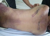 Công an kết luận nguyên nhân 1 bị can chết tại trại Chí Hoà ảnh 2 1 phạm nhân tử vong trong trại giam