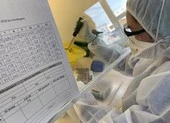 Kit test của Việt Á: Quảng Ngãi mua 5 tỉ, CDC Quảng Nam dùng ‘hàng tài trợ’ ảnh 2 CDC TPHCM không mua kit test của công ty Việt Á vì giá quá đắt