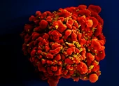 Em bé thứ ba trên thế giới được chữa khỏi HIV