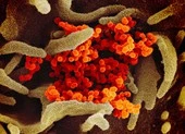 Biến đổi gen ở virus COVID-19 tương tự biến đối ở HIV, Ebola