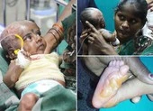 Người mẹ tự đốt cháy hai con để ... được thế giới chú ý?