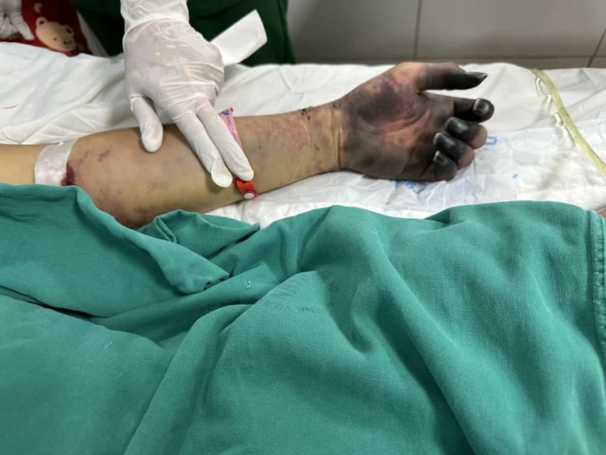 Liên cầu lợn