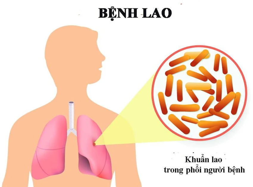 Thủ tướng.jpg