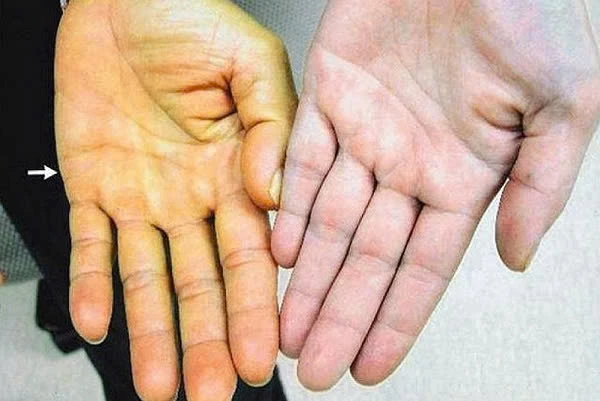 lá lộc mại