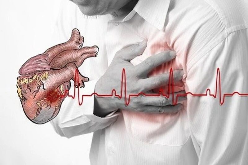 ngừng tim đột ngột