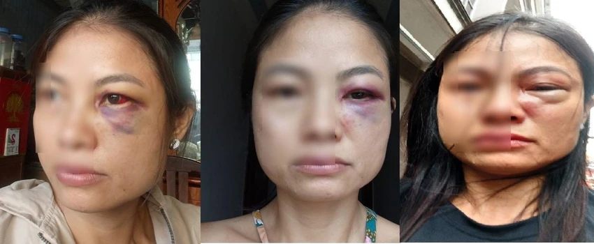 Người phụ nữ cho rằng chồng liên tục bạo hành bà và những đứa con. Ảnh: VH Người phụ nữ cho rằng chồng liên tục bạo hành bà và những đứa con