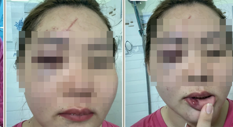 Cô N bị chồng đánh trọng thương. Ảnh: NVCC Cô N bị chồng đánh trọng thương. Ảnh: NVCC