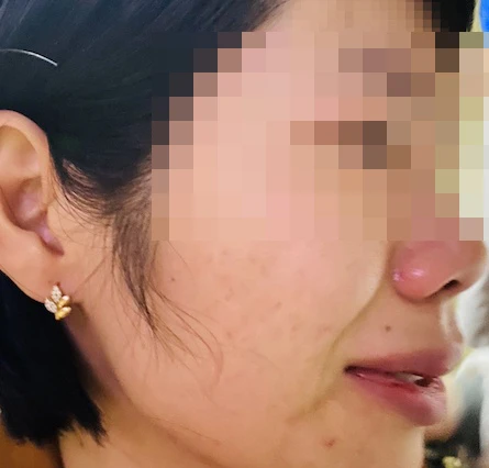 Cô Vũ Thị Kim Quy bị phụ huynh học sinh đánh trọng thương. Ảnh: NVCC Cô Vũ Thị Kim Quy bị phụ huynh học sinh đánh trọng thương. Ảnh: NVCC