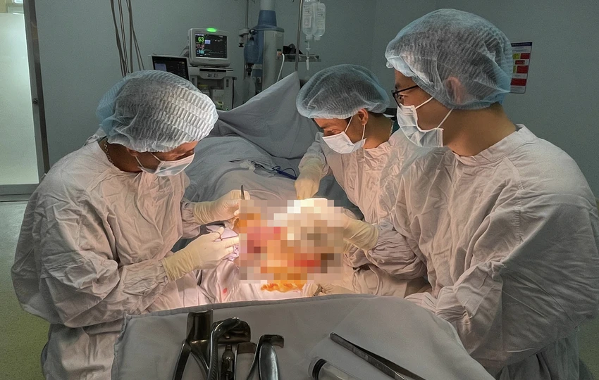 Các bác sĩ phẫu thuật cho ông NVH. Ảnh: HA Các bác sĩ phẫu thuật cho ông NVH. Ảnh: HA