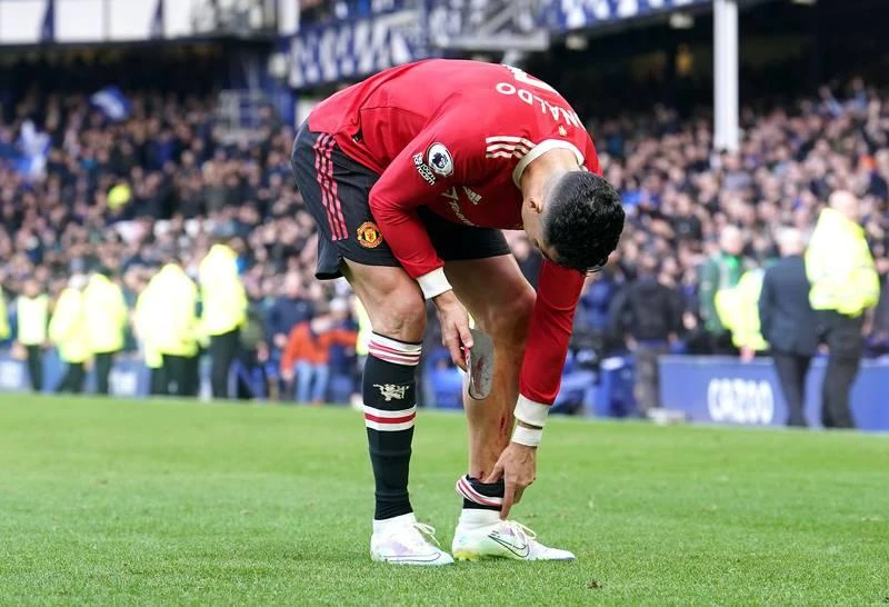 Vết xây xát ngay "ống đồng" của Ronaldo Ronaldo hầu như bị phong tỏa và không làm ăn được gì Đội hình...lởm khởm của MU khiến Ronaldo khổ quá MU ngày nay chứ không phải "Dải thiên hà" ngày nào của Real Madrid Ronaldo à. Vẫn cởi sóng, cởi gió" nhưng Ronaldo vẫn bế tắc Đối thủ lại chơi rất rát Nụ cười chua chát và bế tắc. Sau trận đấu, Ronaldo còn đập vỡ điện thoại của một fan nhí trong khi anh rời sân. Cảnh sát đang tiến hành điều tra hành vi của Ronaldo.