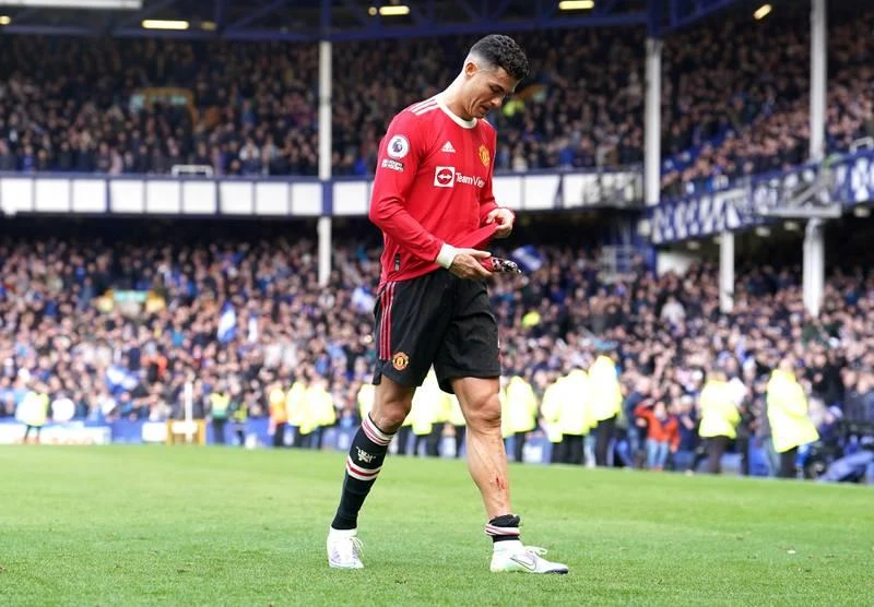 MU thua, Ronaldo lại bị đối thủ chơi xấu. Vết xây xát ngay "ống đồng" của Ronaldo Ronaldo hầu như bị phong tỏa và không làm ăn được gì Đội hình...lởm khởm của MU khiến Ronaldo khổ quá MU ngày nay chứ không phải "Dải thiên hà" ngày nào của Real Madrid Ronaldo à. Vẫn cởi sóng, cởi gió" nhưng Ronaldo vẫn bế tắc Đối thủ lại chơi rất rát Nụ cười chua chát và bế tắc. Sau trận đấu, Ronaldo còn đập vỡ điện thoại của một fan nhí trong khi anh rời sân. Cảnh sát đang tiến hành điều tra hành vi của Ronaldo.