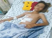 Đi cắt lúa thuê, bé trai nhà nghèo bị thanh sắt đâm thấu ngực
