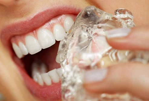 10 thói quen khiến răng dễ gãy ảnh 1 10 thói quen khiến răng dễ gãy ảnh 1