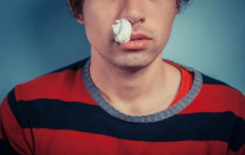 Ngăn ngừa chứng chảy máu cam trong mùa đông ảnh 1 Ngăn ngừa chứng chảy máu cam trong mùa đông ảnh 1
