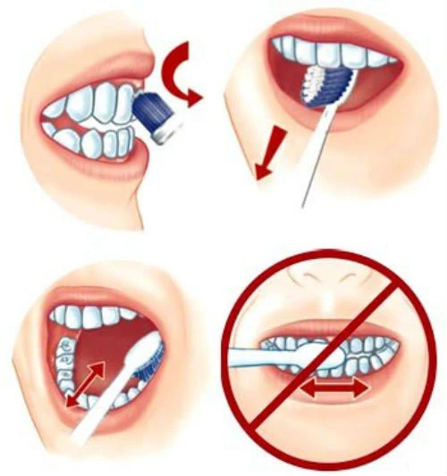 Ngừa ung thư miệng bằng đánh răng đúng cách ảnh 3