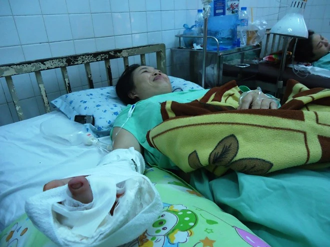 Tạo ngón tay bằng… ngón chân của bệnh nhân ảnh 1 Tạo ngón tay bằng… ngón chân của bệnh nhân ảnh 1