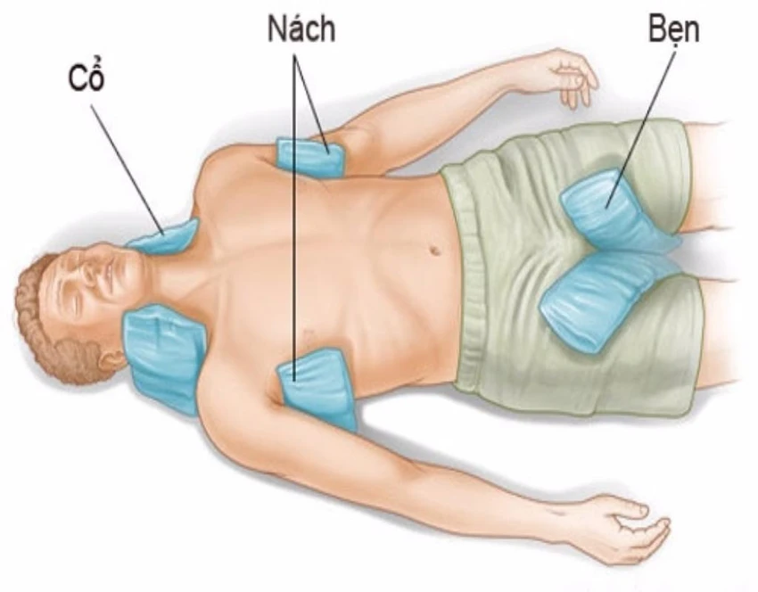sơ cứu khi bị sốc nhiệt