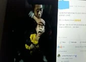 Bé trai bị chó cắn phát dại kêu như chó sủa?