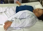 Đi bắt rắn nước bán, bị rắn hổ mang cắn nhập viện