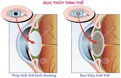 Kính râm, dùng sao cho lợi? ảnh 1