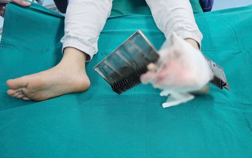Bé trai bị kẹp chân vào thang cuốn