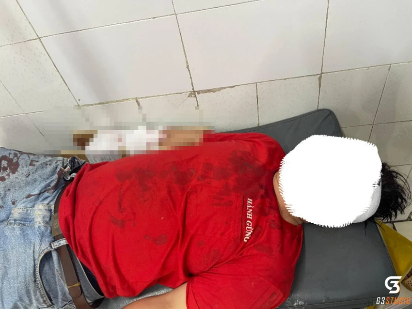 Anh C đang được điều trị tại Bệnh viện TP Thủ Đức. Ảnh: TS Anh C đang được điều trị tại Bệnh viện TP Thủ Đức. Ảnh: TS