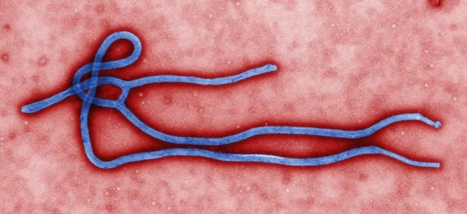 Chùm ảnh đại dịch khủng khiếp Ebola đang đe dọa cả thế giới ảnh 7