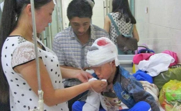 Thầy giáo dạy nghệ thuật đánh học sinh bê bết máu, rạn hộp sọ ảnh 1 Thầy giáo dạy nghệ thuật đánh học sinh bê bết máu, rạn hộp sọ ảnh 1