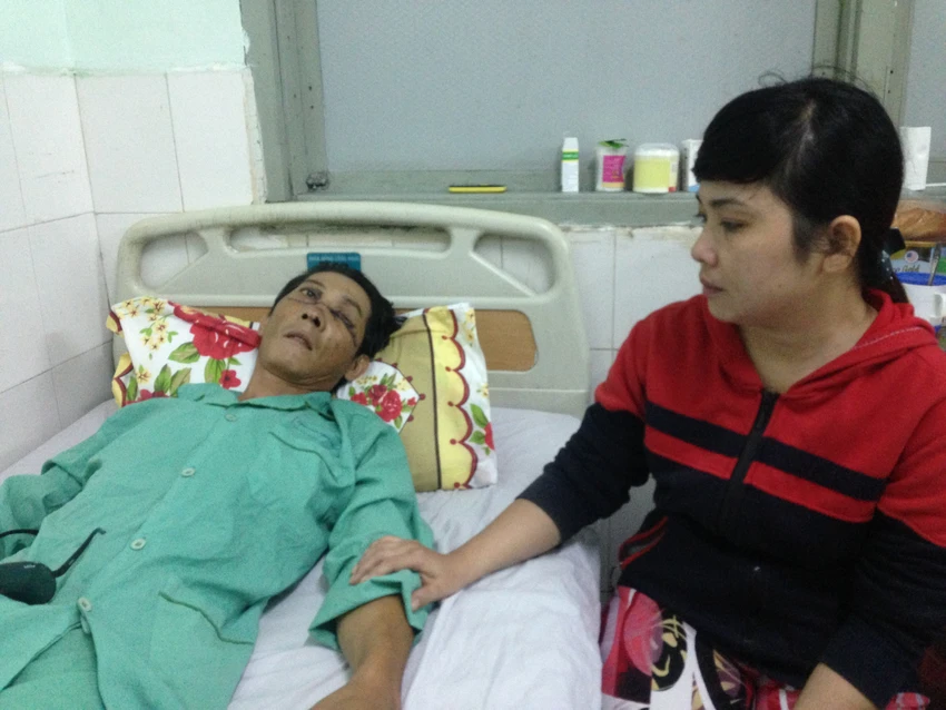 Gãy đôi xương mặt, múc bỏ nhãn cầu trái vì nổ bánh 'xe rùa' ảnh 2 Gãy đôi xương mặt, múc bỏ nhãn cầu trái vì nổ bánh 'xe rùa' ảnh 2