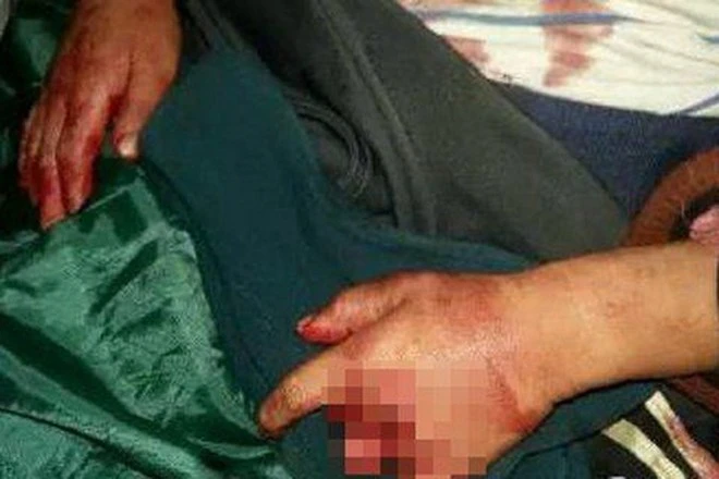 Phẫn nộ bé trai 6 tuổi bị chém, cắt dã man chỉ vì làm ồn ảnh 1